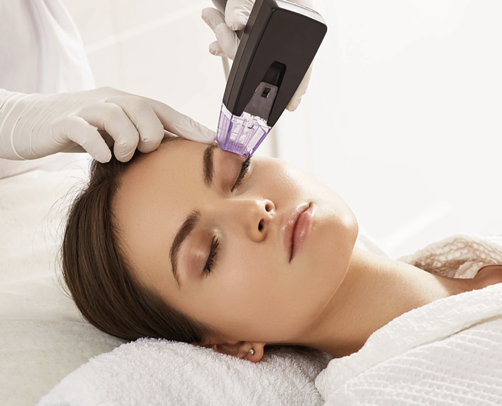 Morpheus8 for Tightening Skin